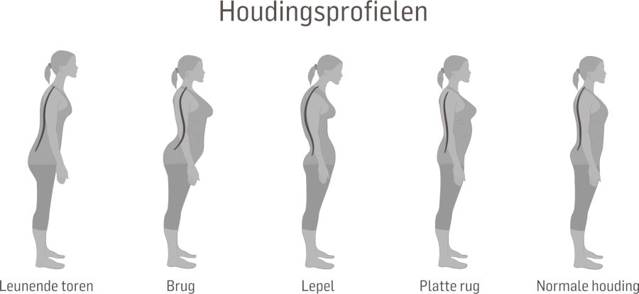 Gezichtsveld Lunch het formulier Rugpijn door zittend werk: oorzaken en tips | Dorsoo