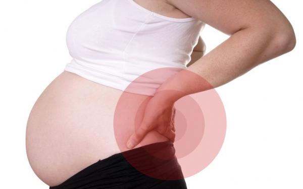 Rugpijn bij zwangerschap - Dorsoo